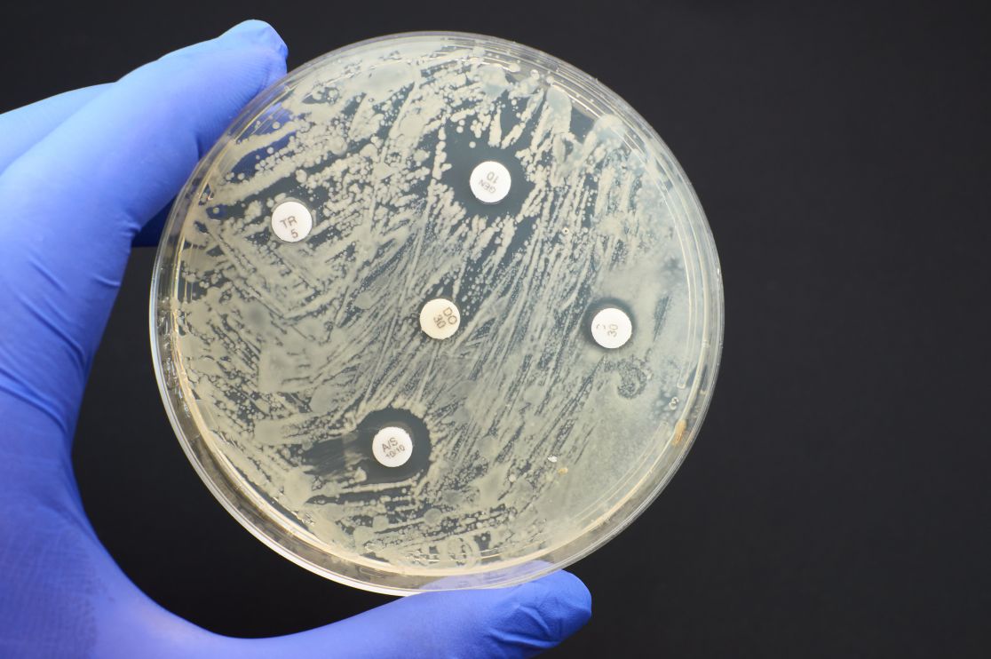Eine Petrischale mit Bakterienabstrich.