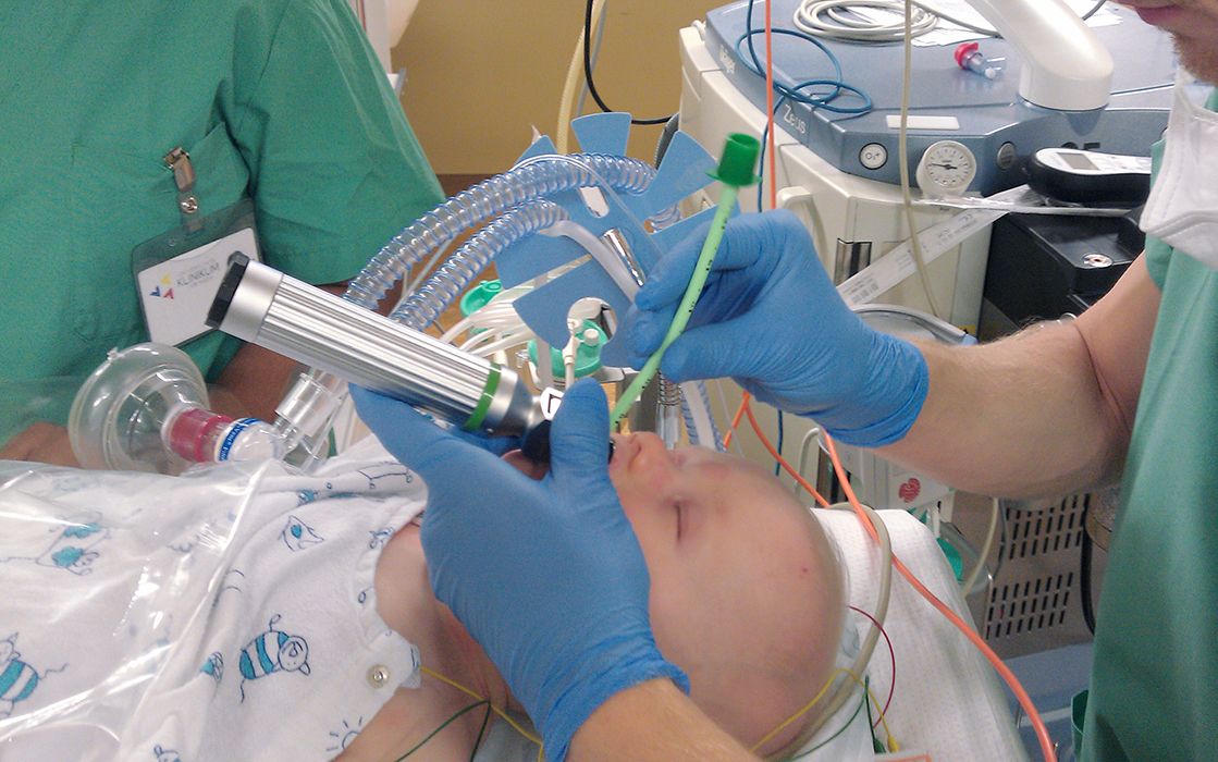 Kind wird anästhesiert