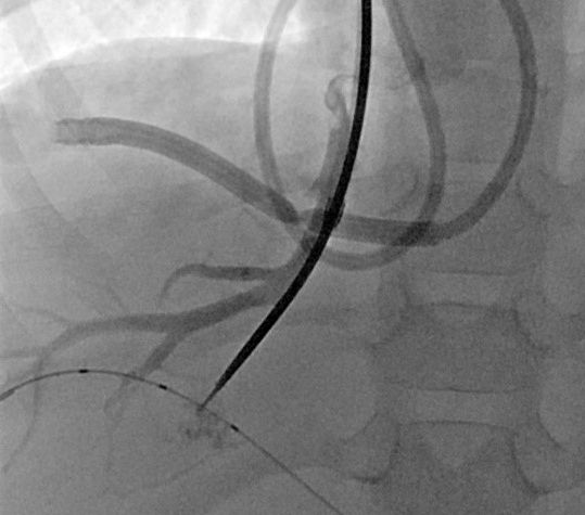 Wissenschaftliche Abbildung TIPS