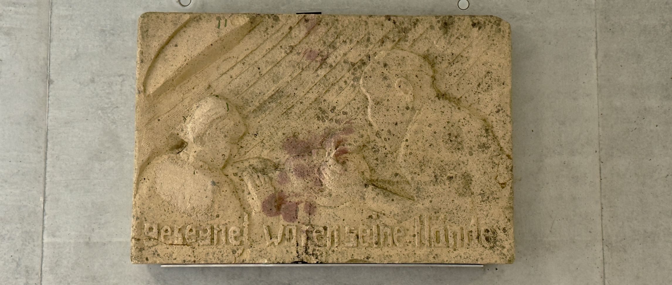 Das Kunstwerk zeigt eine augenärztliche Operationsszene, wie sie sich in den 30iger und 40iger Jahren des 20. Jahrhunderts zugetragen haben könnte.