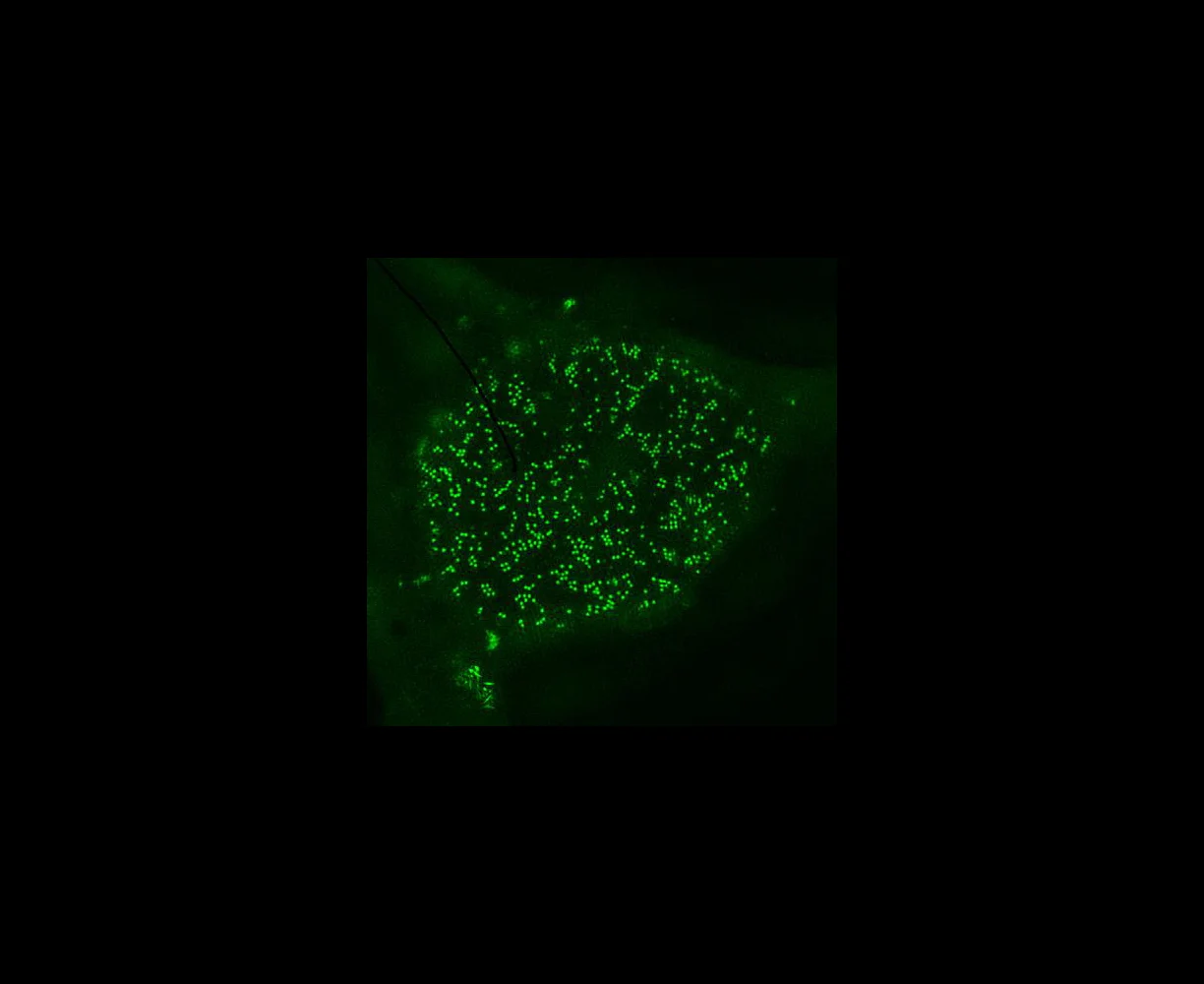 Localization of HIV-1 Vpr to the nuclear membrane revealed by 3D-SIM