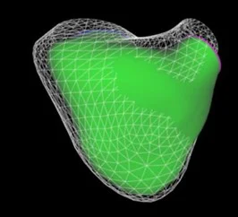3D-Bildgebungsmethode