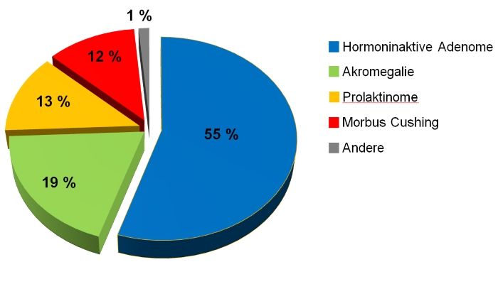 Kuchendiagramm zu Tumoren der Hypophyse