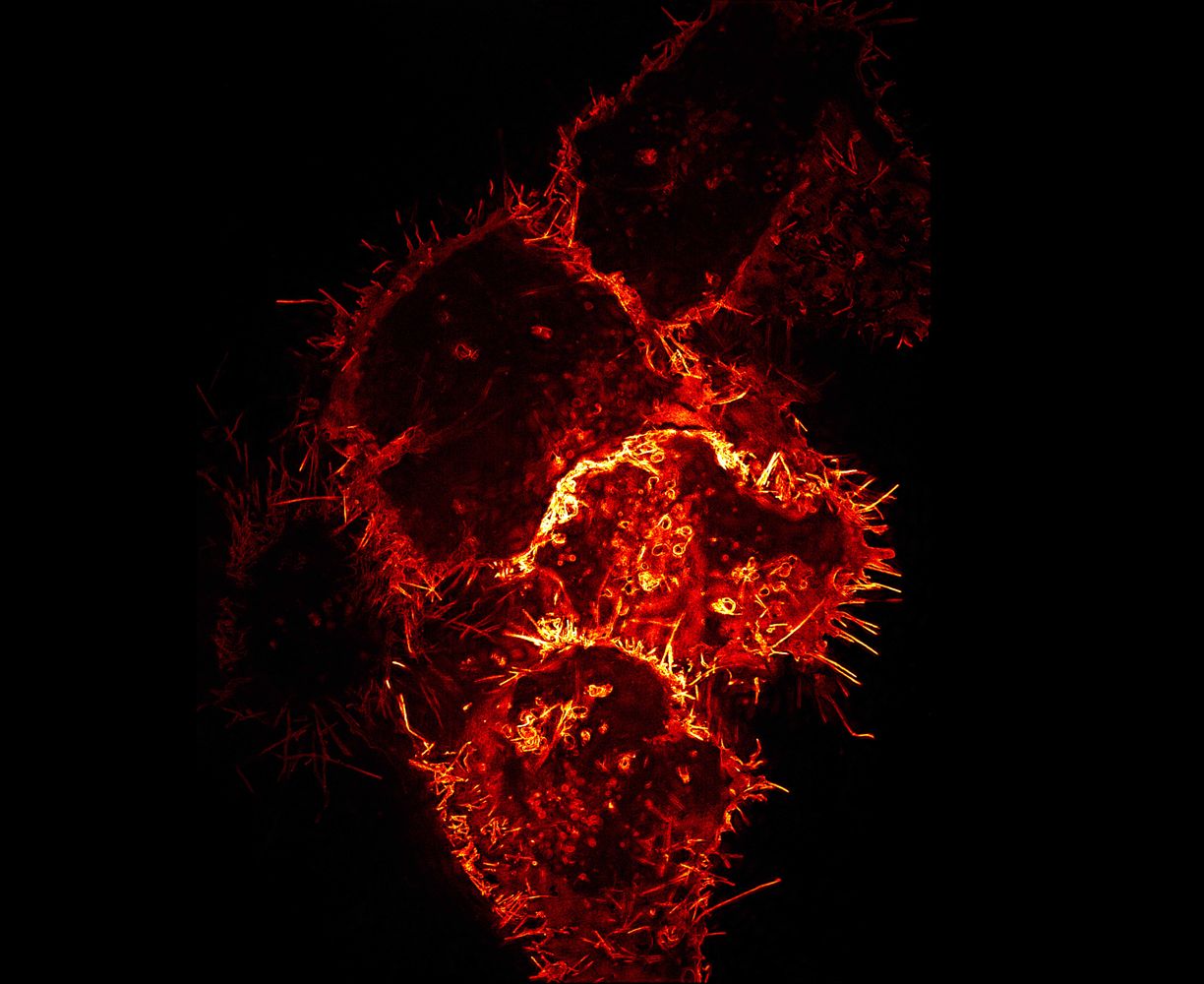 Ebola Glycoprotein localization in HeLa cells imaged by 3D-SIM