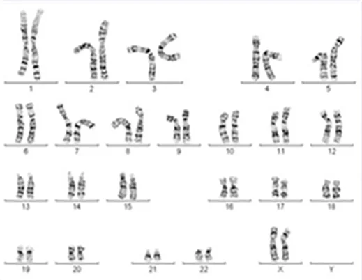 Abbildung weiblicher Chromosomensatz