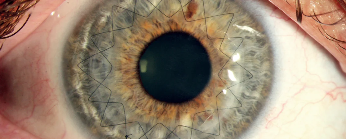 Auge