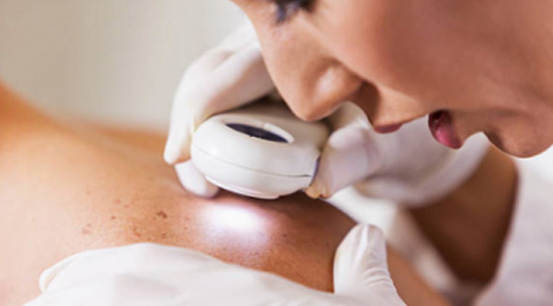 Schmuckbild: Ärztin untersucht Haut mit Lupe