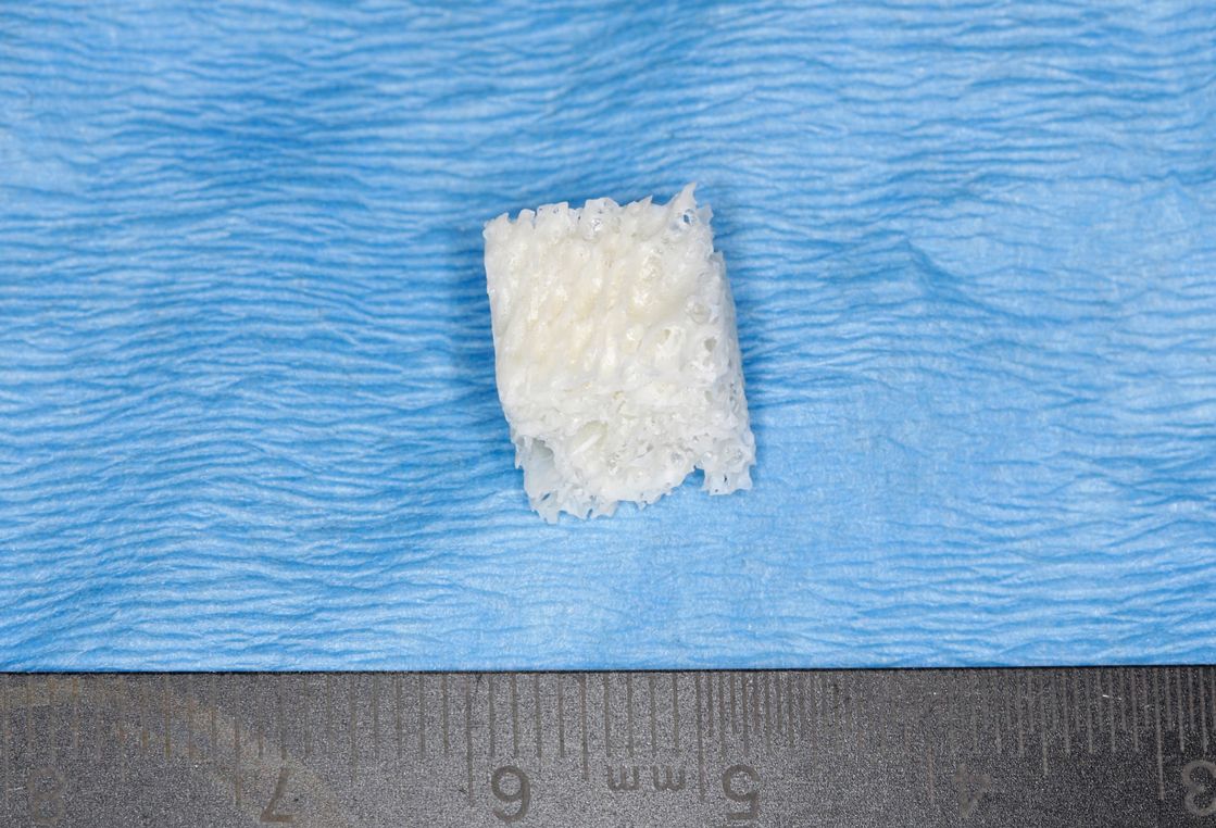 Knochenersatzmaterial