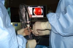 Transnasale Hypophysen-Operation mit dem Endoskop. Der Assistent hält das Endoskop. Das Operationsfeld wird über den Monitor betrachtet.