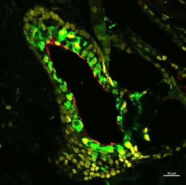 Floureszenzmikroskopische Aufnahme eines Organoids