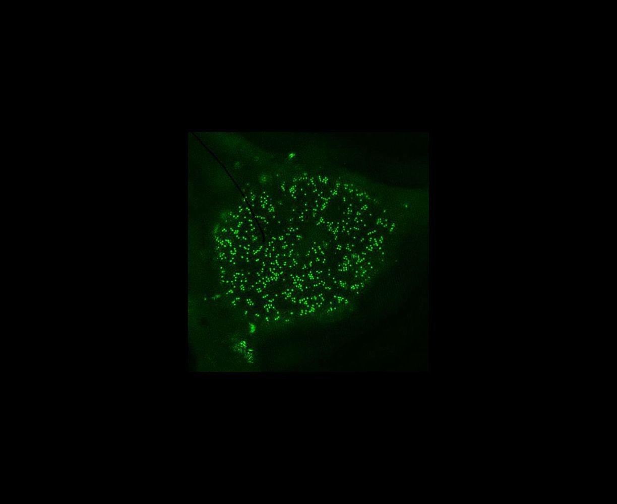 Localization of HIV-1 Vpr to the nuclear membrane revealed by 3D-SIM