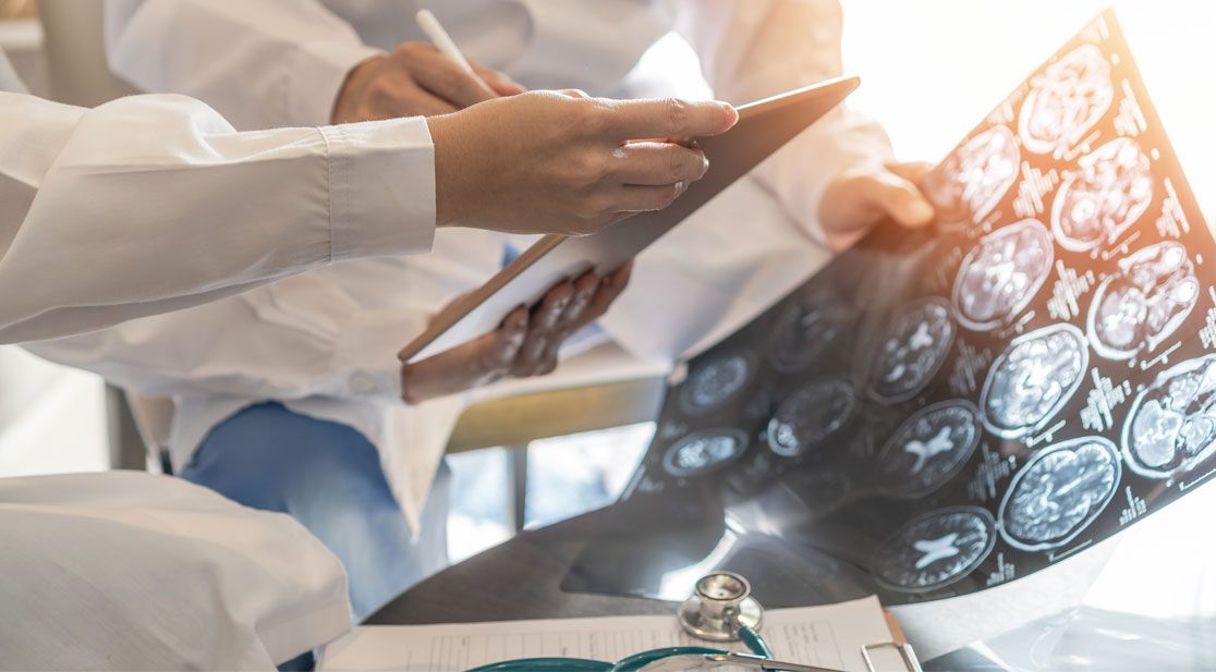 Schmuckbild: Ärzte diskutieren MRT Aufnahmen vom Gehirn