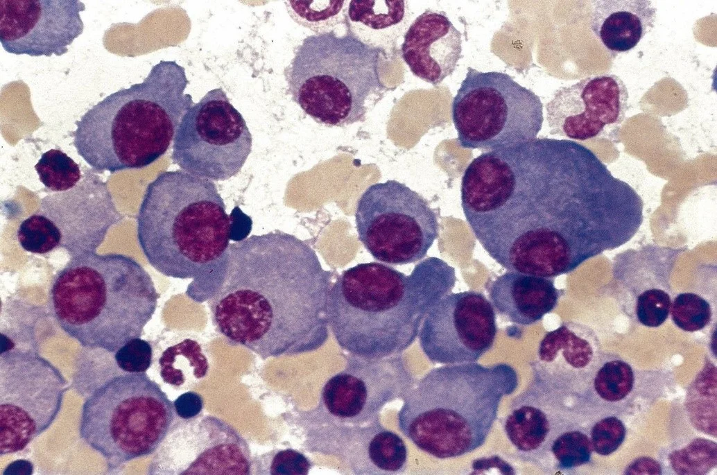 Wissenschaftliche Abbildung: Histologisches Bild der Plasmazellen