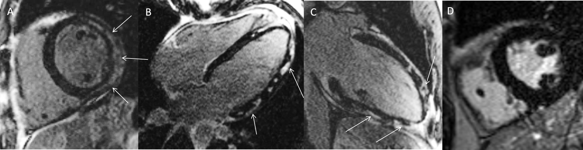 MRT Aufnahme mit Kontrastmittel