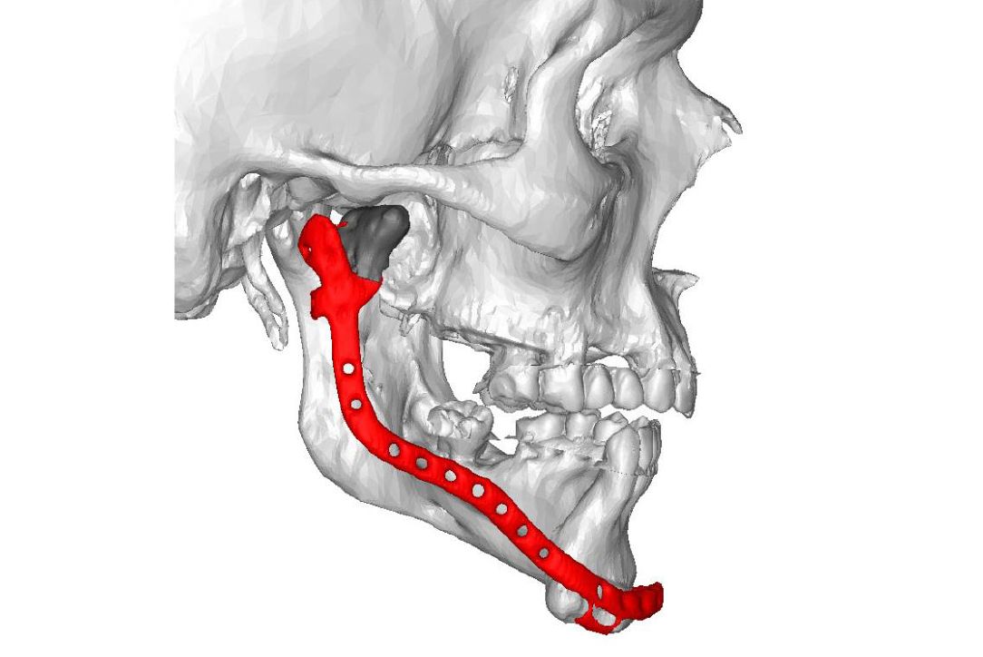 Rekonstruktionsmodell