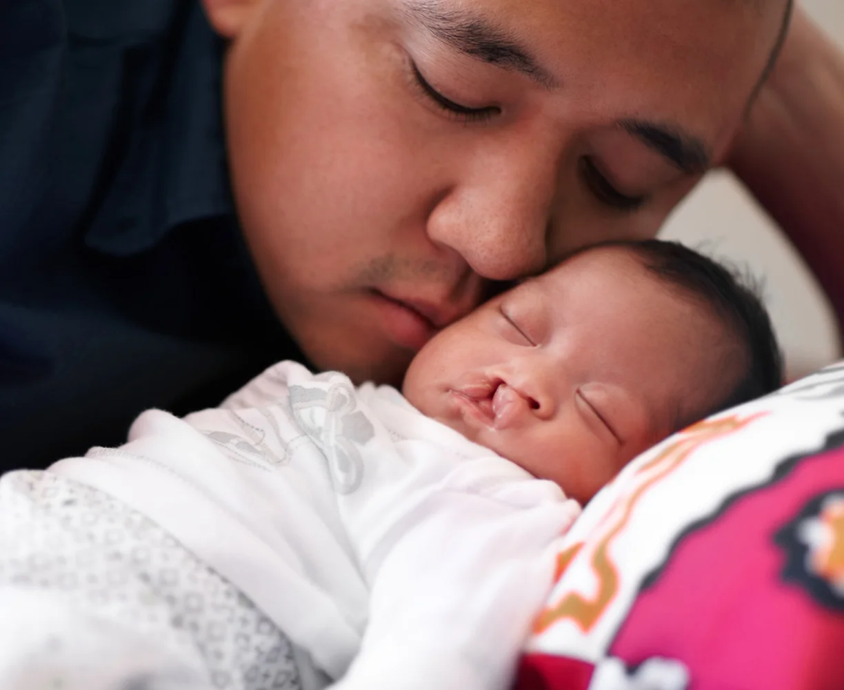 Vater mit Baby das eine Lippen-Kiefer-Gaumenspalte hat