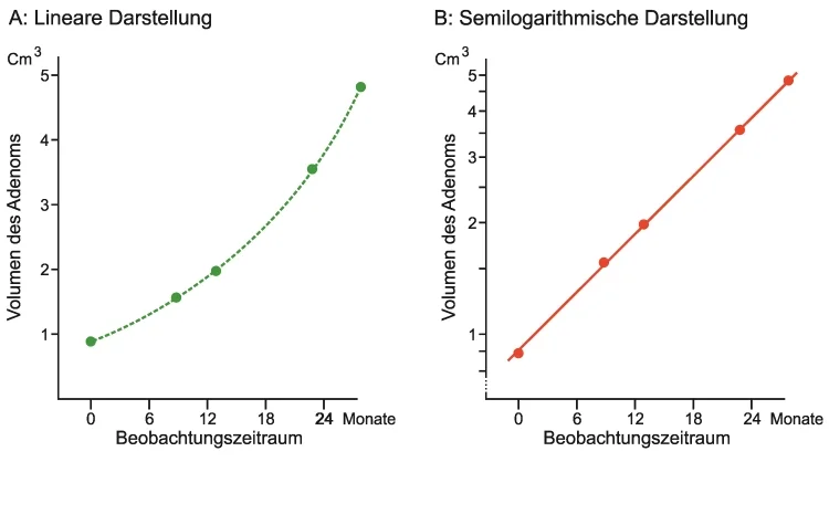Wachstumsdynamik eines schnell wachsenden Hypophysenadenoms. Es zeigt sich ein logarithmisches Wachstum während der gesamten Beobachtungsperiode (links: lineare Darstellung; rechts: semilogarithmische Darstellung).