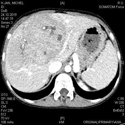 Wissenschaftliche Abbildung CPSS