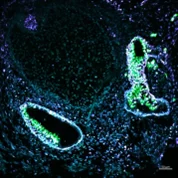 Floureszenzmikroskopische Aufnahme eines Organoids