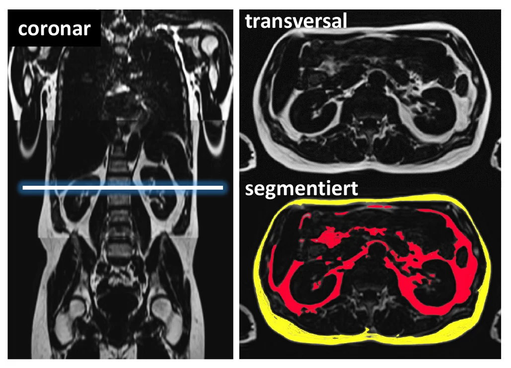 MRT Bilder mit Diagnostik