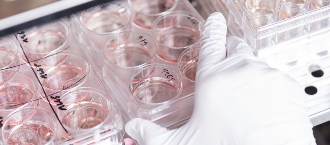 Petrischalen im Labor