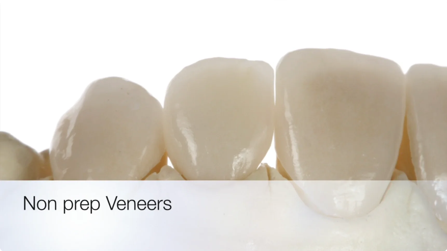 Startfolie Video: Zähne mit Titel Non prep veneers