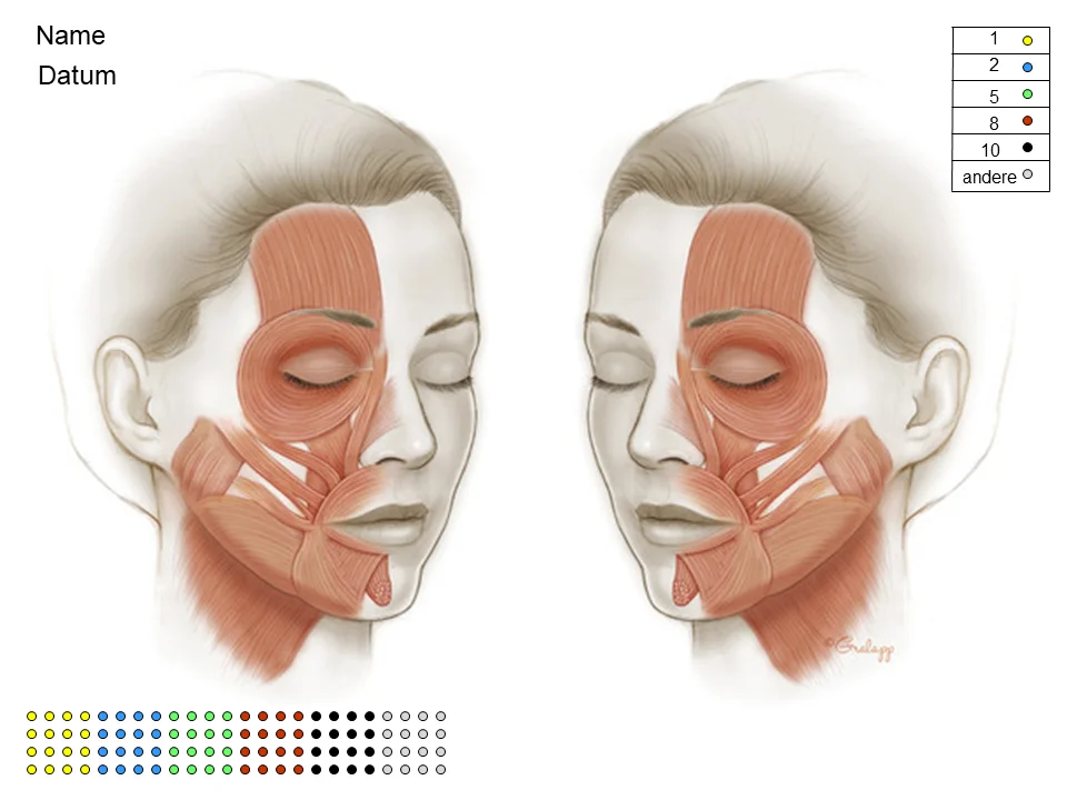 Abbildung 10: Botulinumtoxin-Schema zur Dokumentation der Synkinesie-Therapie (farbliche Kodierung der applizierten Botulinumtoxin-Dosis je Injektionsstelle)