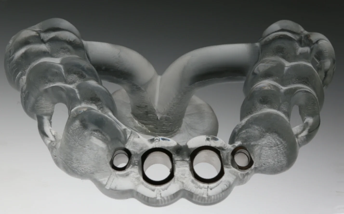 Foto einer Schablone für die Implantate