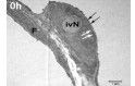 intravaskulärer PMN