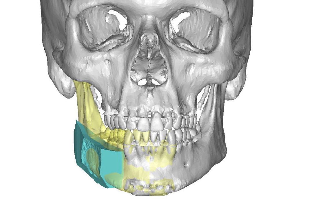 Rekonstruktionsmodell