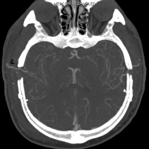 CT Schnittbildgebung