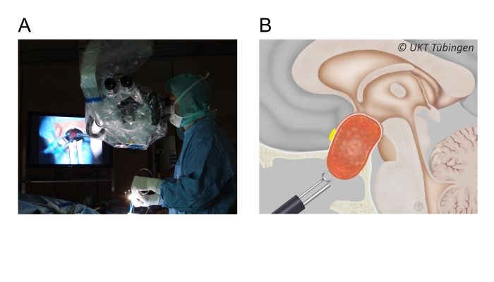 Links Foto einer OP, rechts schematische Darstelltung der OP