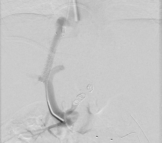 Wissenschaftliche Abbildung TIPS