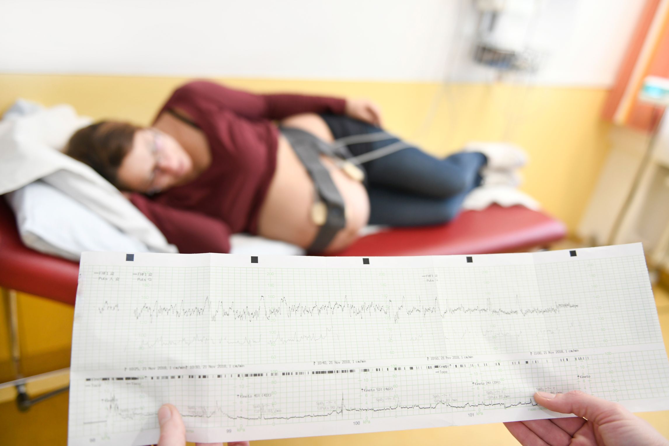 Ausdruck aus dem Wehenschreiber