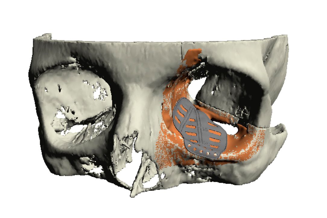 Rekonstruktion Computermodell