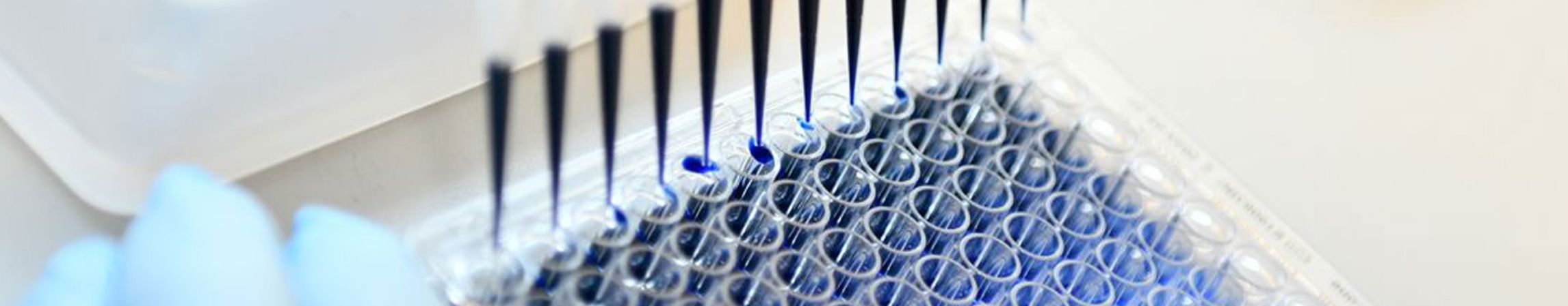 Schmuckbild: Eppendorfcups mit blauer Flüssigkeit