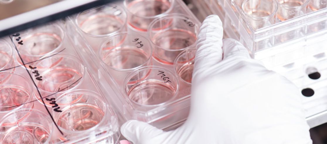 Petrischalen im Labor