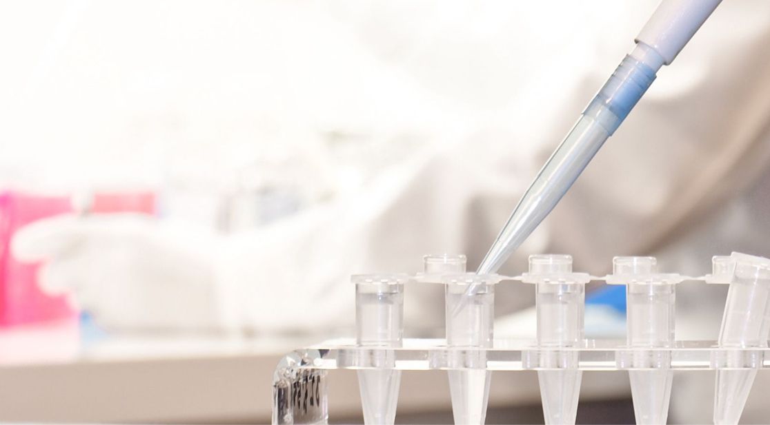 Pipette und Eppendorfcups