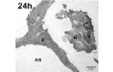 PMN im Alveolarraum