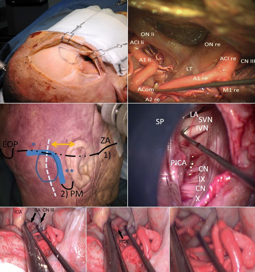 Fotokollage zur wissenschaftliche Arbeit am neuroanatomischen Modell