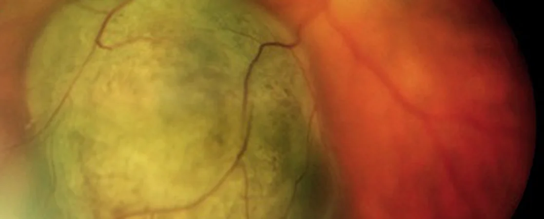 Auge Adern