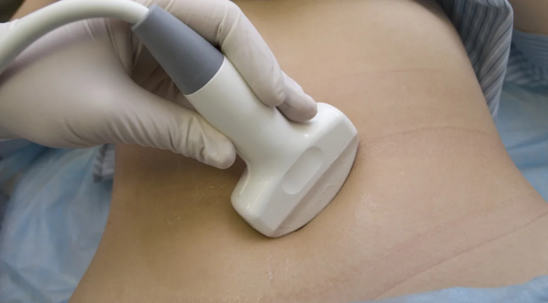 Sonografie eines Körperteils