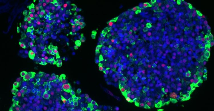 Beispiel von 3D Zellkulturen von Hypophysenadenomen. Grün: Nachweis von Zellen mit mTOR (wichtiges Protein für zelluläre Signalwege). Rot: Zellen in der Teilungsphase (Abbildung zur Verfügung gestellt von N. Pellegata, Helmholtz Center Munich).