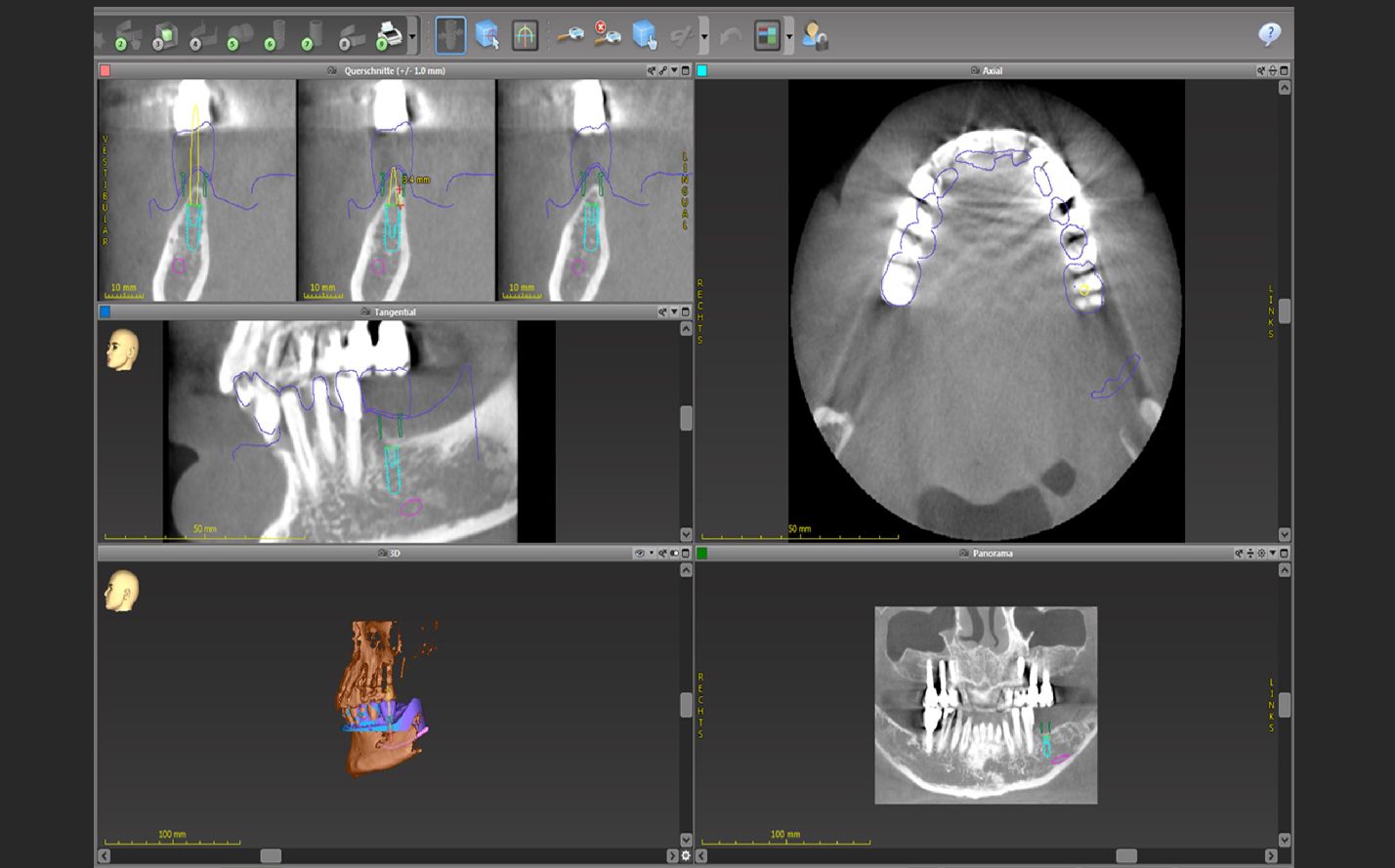 Bildschirmfotos aus dem Planungsprogramm
