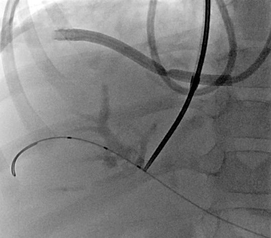 Wissenschaftliche Abbildung TIPS