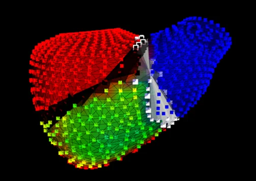 Segmentale 3D-Volumetrie des rechten Ventrikels