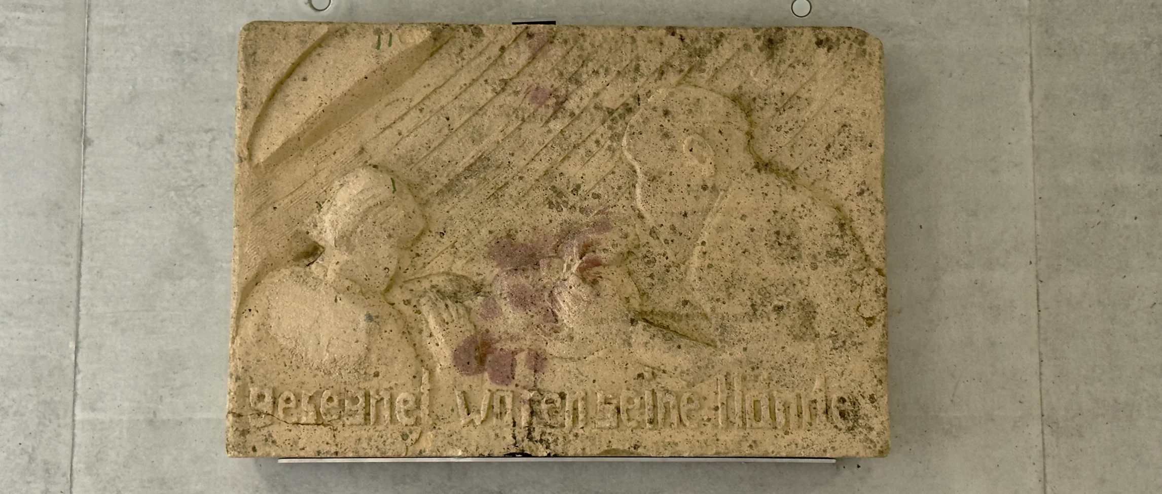 Das Kunstwerk zeigt eine augenärztliche Operationsszene, wie sie sich in den 30iger und 40iger Jahren des 20. Jahrhunderts zugetragen haben könnte.