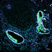 Floureszenzmikroskopische Aufnahme eines Organoids