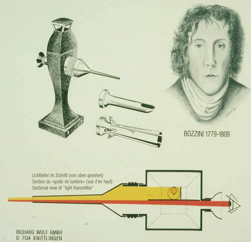 Links oben: Abbildung des circa 35 cm hohen Lichtleiters von Bozzini mit verschiedenen "Sehröhrchen ", rechts oben: Selbstbildnis von Philipp Bozzini, unten: Schematischer Querschnitt des Lichtleiters.