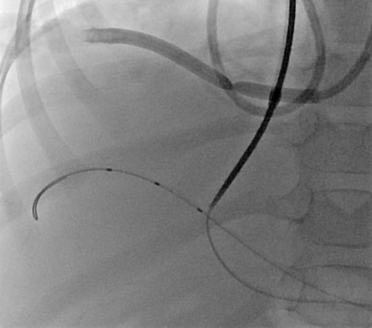 Wissenschaftliche Abbildung TIPS